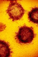 Covid19 coronavirus épidémiologie Covid-19 pandémie phase 3 France Europe